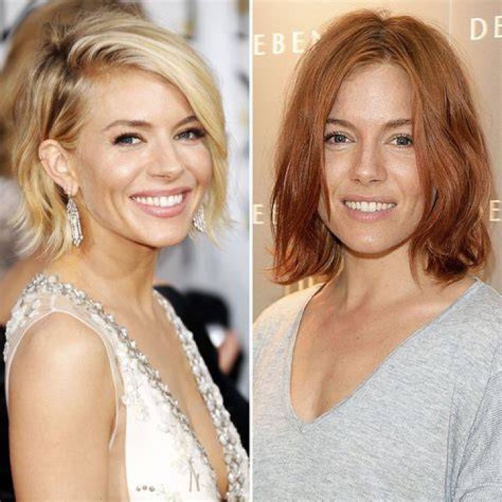 13 Of The Most Drastic Celebrity Plastic Surgeries