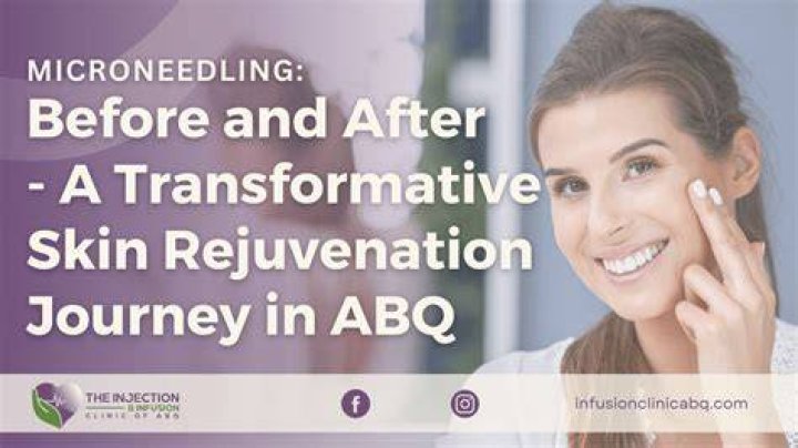 A Journey To Skin Rejuvenation