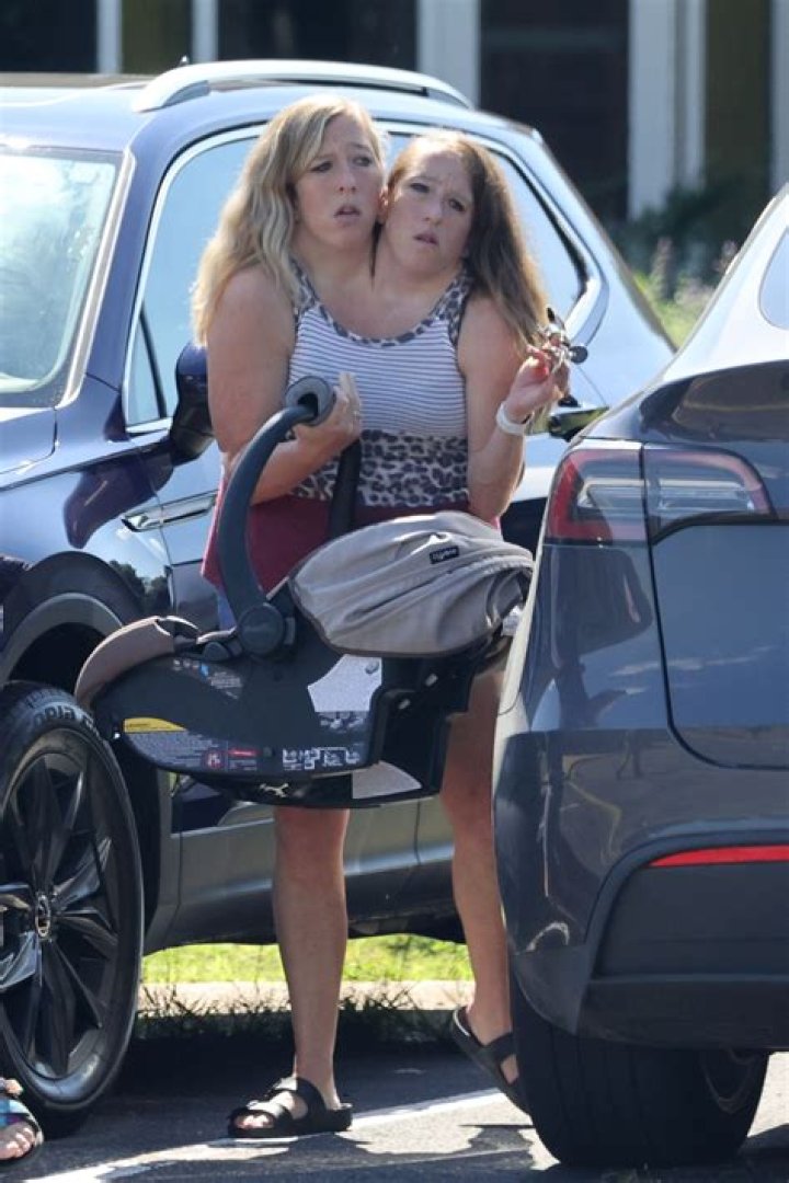 Abby and brittany hensel conjoined twins engaged pnafile