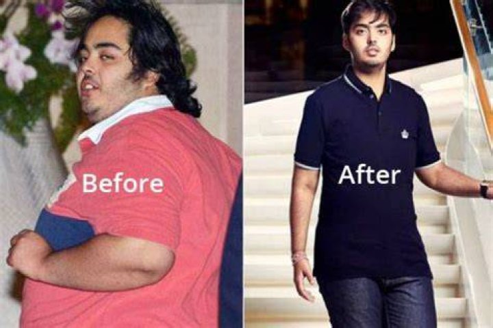 Anant Ambani Extreme Weight Loss This Diet Helped Mukesh Ambani&rsquo;s Son