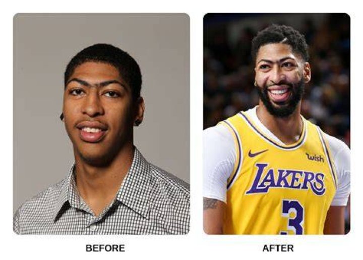 Anthony Davis' Early Years: Exploring His Childhood Roots