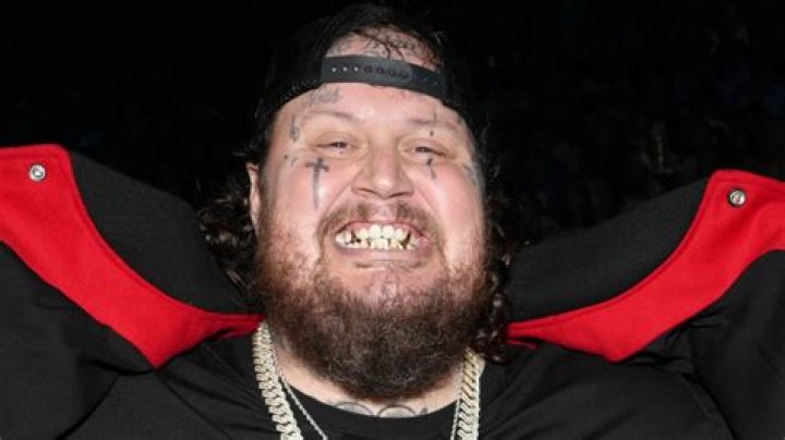 Are Jelly Roll's Teeth Rotten?