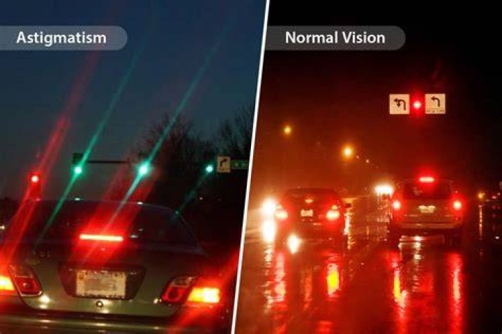 Astigmatism Causes, Symptoms, Diagnosis, and Treatment