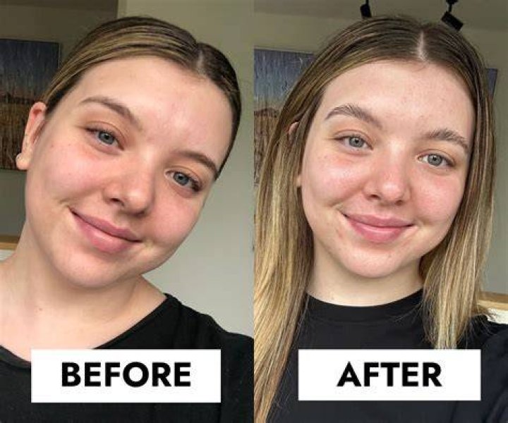 Before And After Photo ·