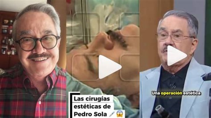 &iquest;Cu&aacute;ntas cirug&iacute;as se ha hecho Cristiano Ronaldo? As&iacute; cambi&oacute; el astro
