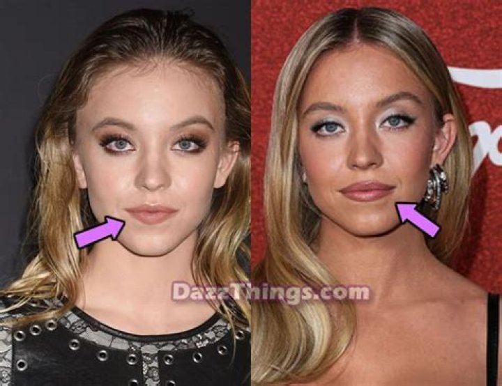 Did Sydney Sweeney Get Plastic Surgery? Transformation Photos Life