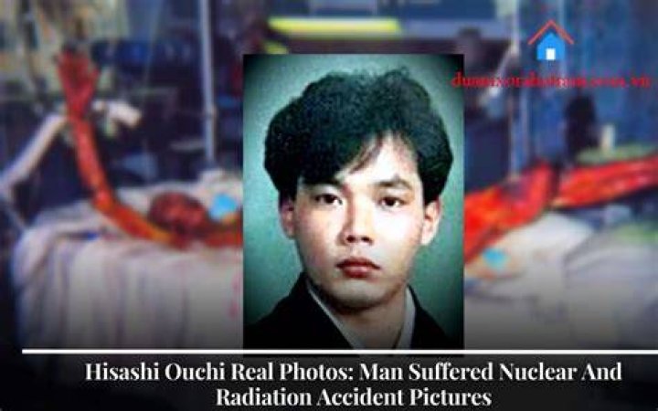 Discover The Unseen: Hisashi Ouchi's Real Life Photos