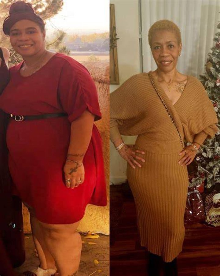 Discoveries Before Weight Loss Surgery