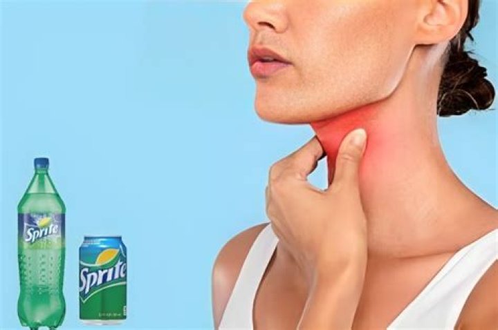 Does Drinking Sprite Help Sore Throat? Facts Checked (2023)