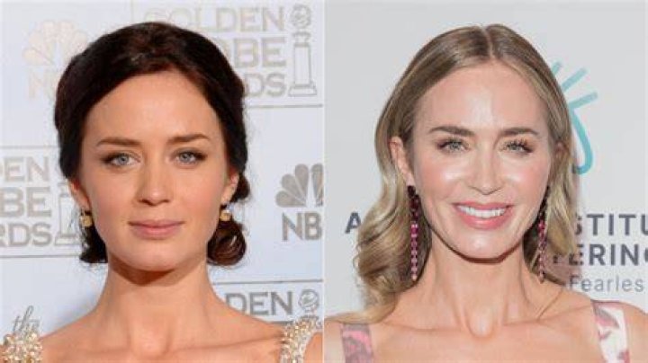 Does Emily Blunt Have Hearing Loss? The Truth Revealed