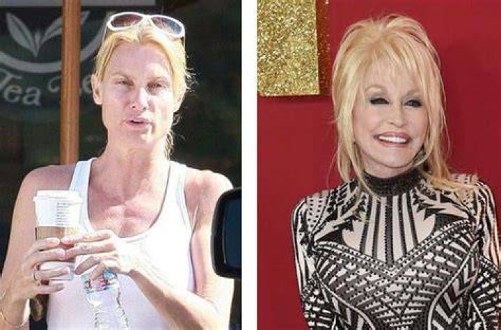 Dolly Parton Without Makeup And Wig Beauty Fzl99 in 2023 Dolly