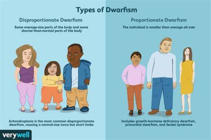Dwarfism Causes, Symptoms, Types Of Dwarfism & Treatment