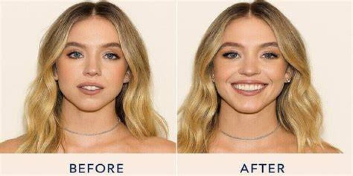 Essential Guide To Sydney Sweeney's Alleged Plastic Surgery Procedures