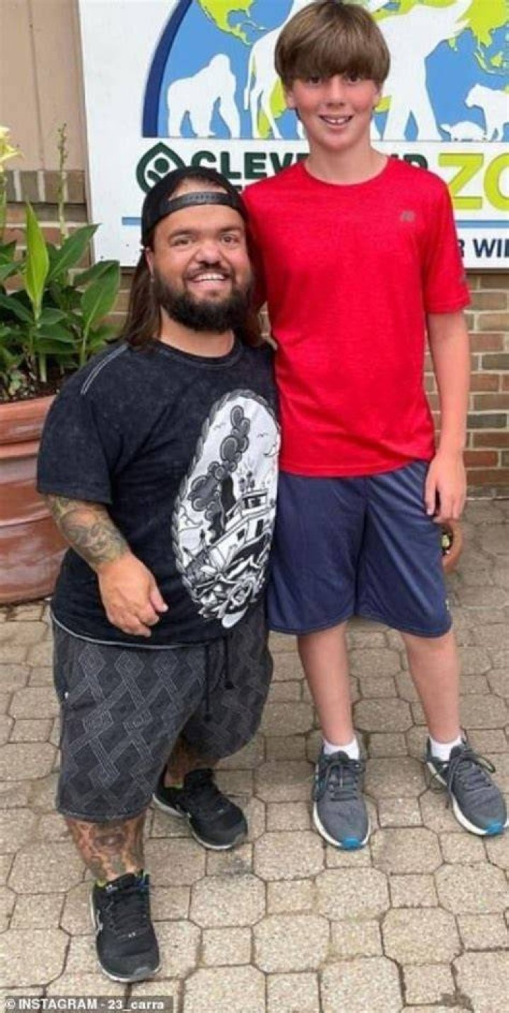 Exploring Dwarfism And Its Impact