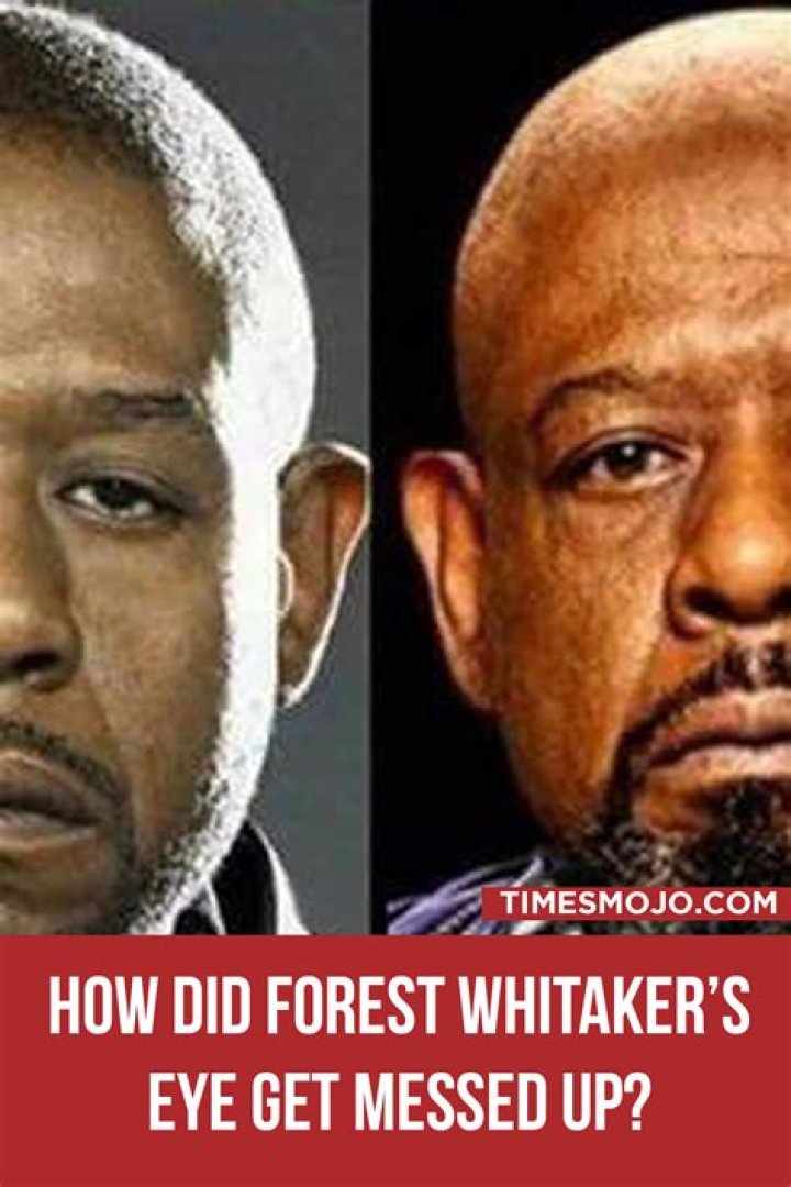 forest whitaker eye