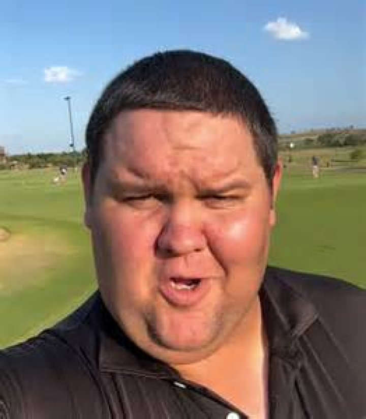 Guy With a BaseballSized Zit on His Head Asks &lsquo;Dr. Pimple Popper&rsquo; For