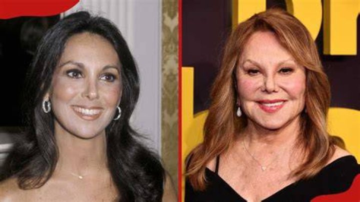 Has Marlo Thomas Undergone Plastic Surgery?