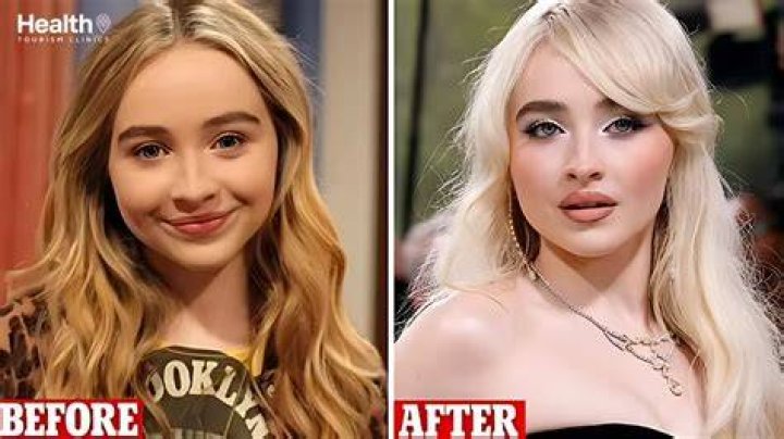 Has Sabrina Carpenter's Surgery Gotten Under Your Skin? The Truth Revealed