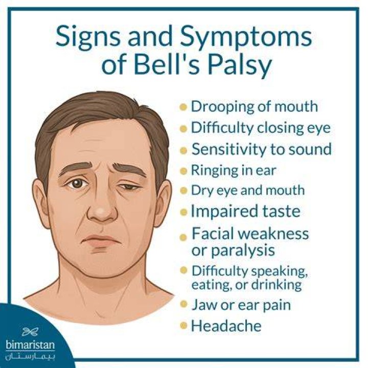 Hollywood Stars Struck With Bell's Palsy