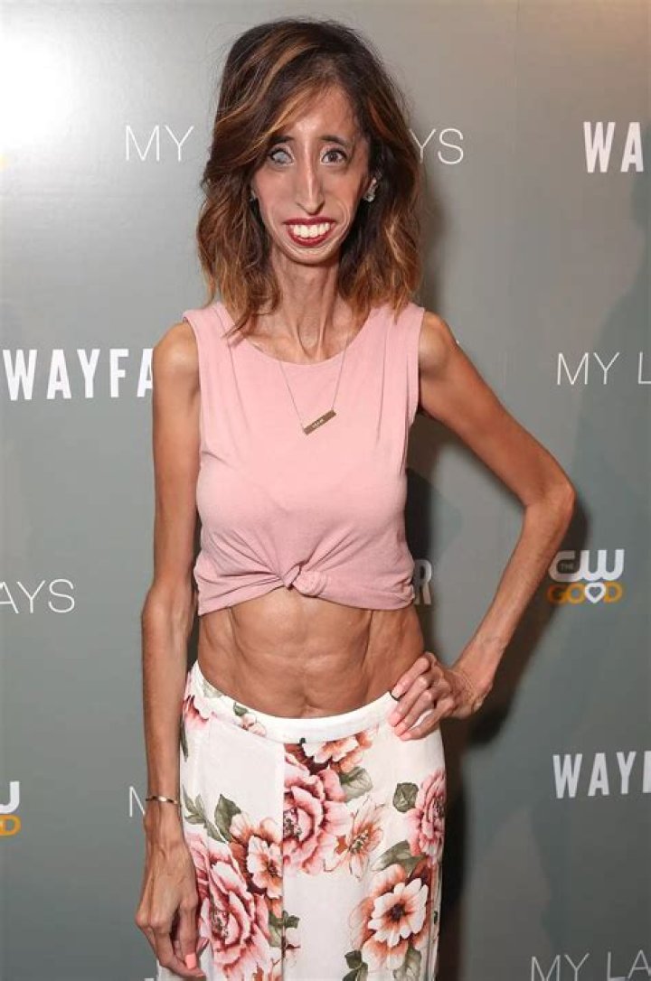 How much does the skinniest person in the world weigh?