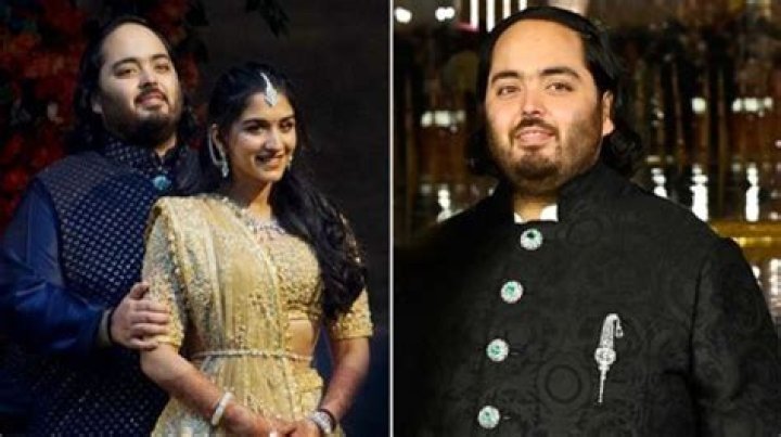 Is Anant Ambani Physically Disabled? Answering The Rumors