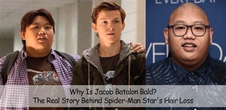 Jacob Batalon's Baldness And The Story Behind It