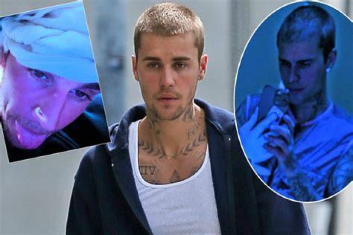 Justin Bieber shares shocking health update with fans after canceling