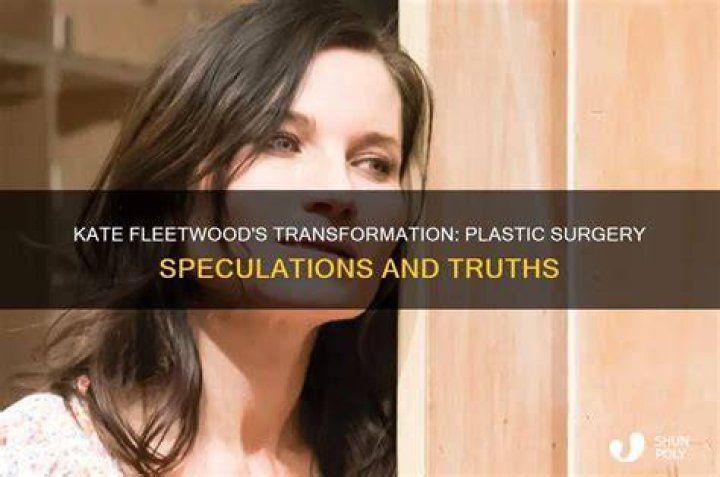 Kate Fleetwood's Plastic Surgery Journey