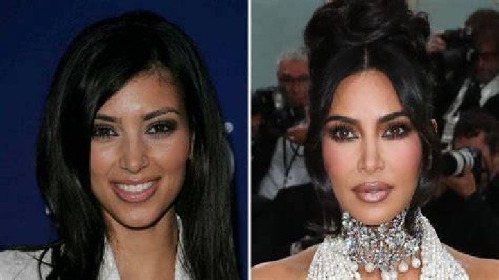 Kim Kardashian Before Plastic Surgery Pics
