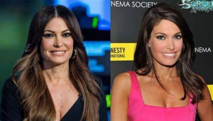 Kimberly Guilfoyle: A Journey Of Transformation Before And After