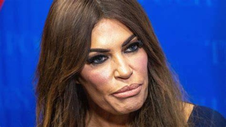 Kimberly Guilfoyle's Plastic Surgery: Unlocking Secrets And Revelations