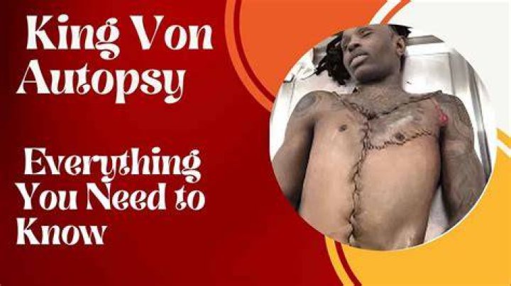 king Von Autopsy Images Leaked Who was Behind Stars Death? Tech Starlink