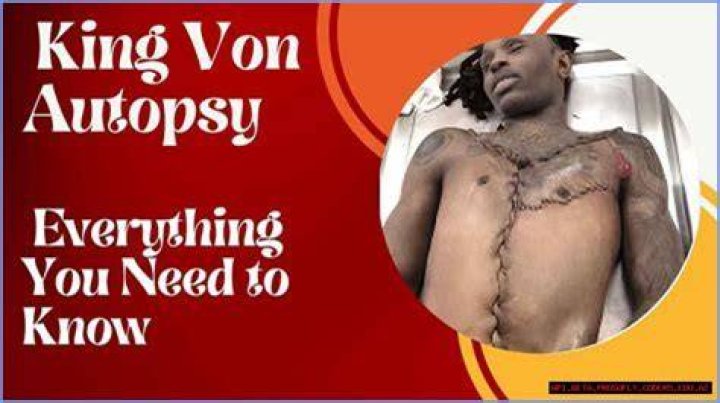 King Von Autopsy Reveals Startling Discoveries