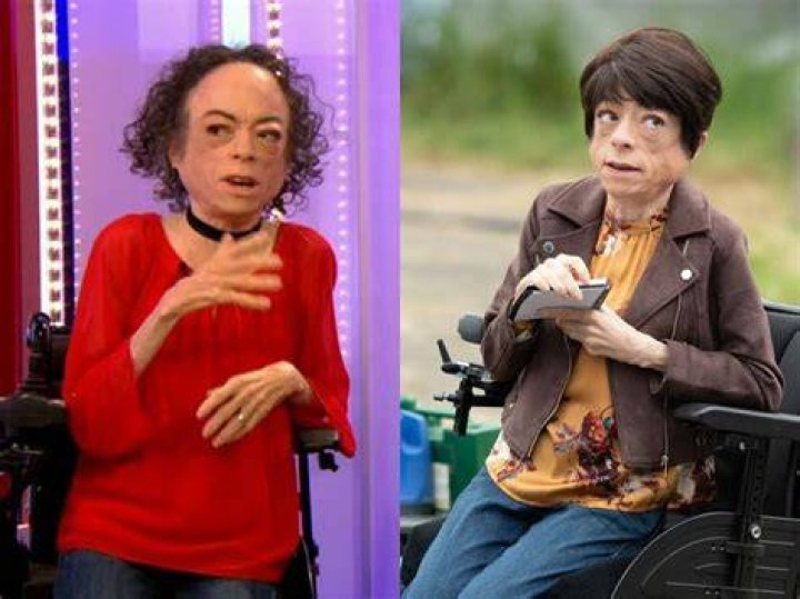 Liz Carr Bio, Net Worth, Wife, Age, Disability, Facts, Career, Wiki