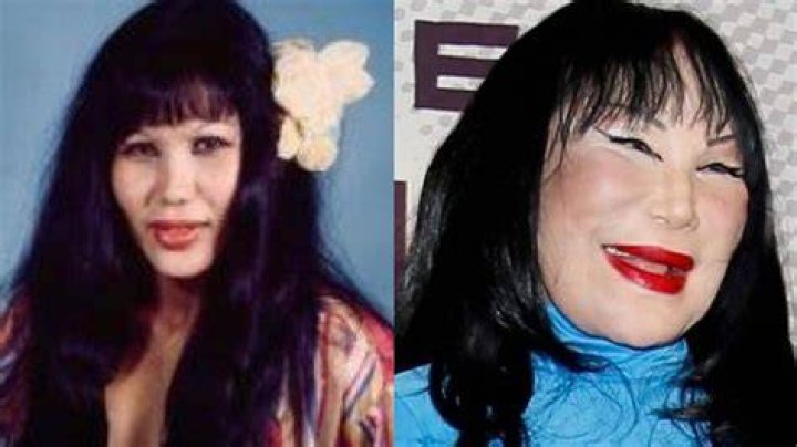 Lyn May Plastic Surgery Destroyed Her Face What Happened to Lyn May