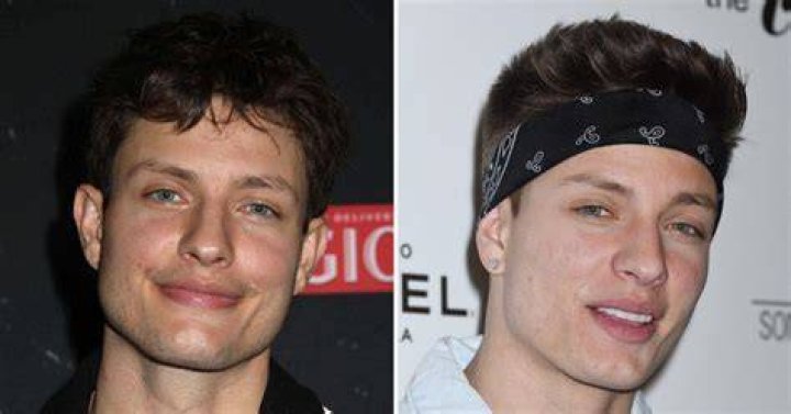 Matt Rife&rsquo;s Plastic Surgery Check Out His Before and After Pictures