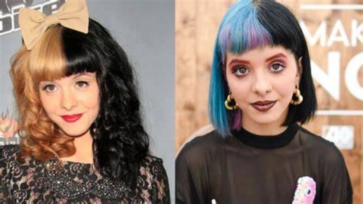 Melanie Martinez Plastic Surgery: A Comprehensive Analysis