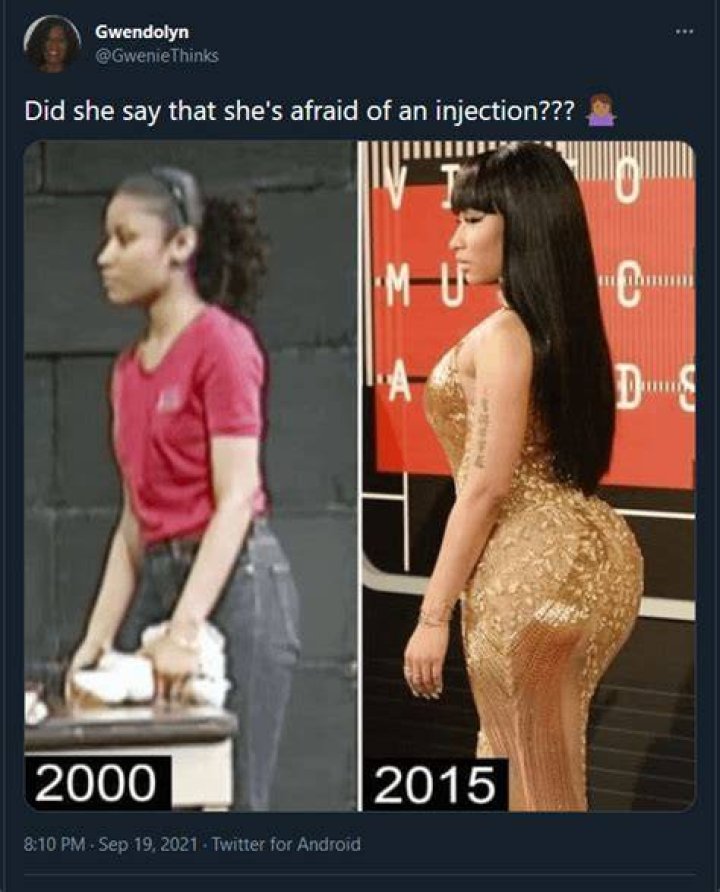 Nicki Minaj's Booty Implants: Before And After Photos And Rumors