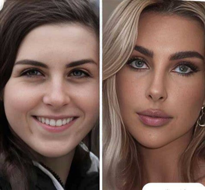 Paige Lorenze Plastic Surgery