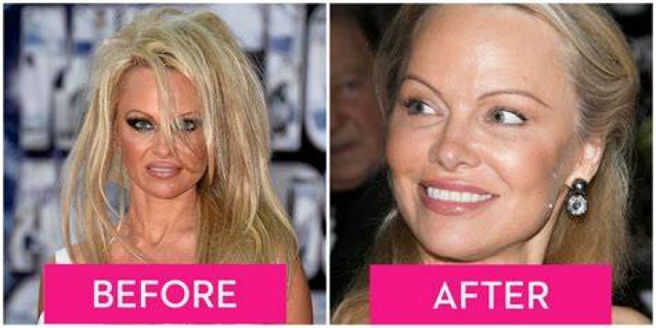 Pamela Anderson's Natural Beauty: Unfiltered And Stunning