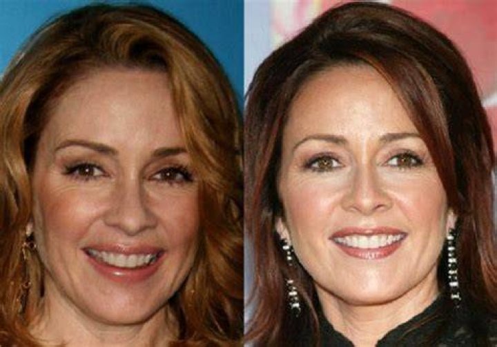 Patricia Heaton Plastic Surgery breasts(tits) and boobs