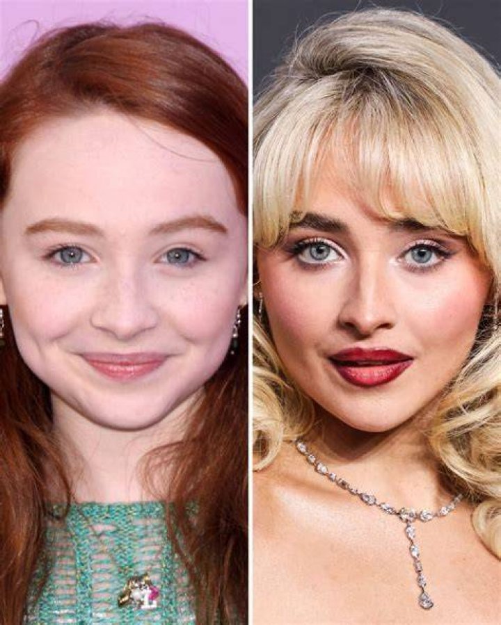 Sabrina Carpenter's Face Surgery: A Detailed Guide