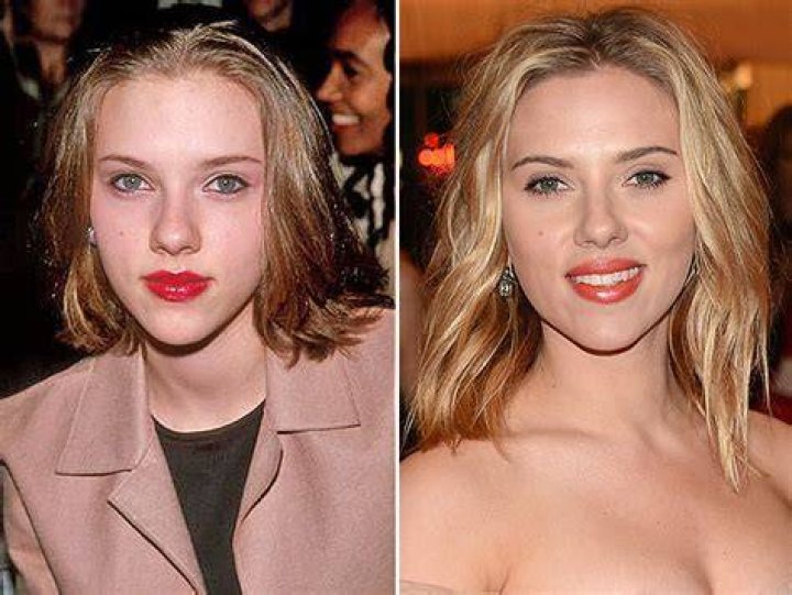 Scarlett Johansson's Plastic Surgery: Uncovering The Truth