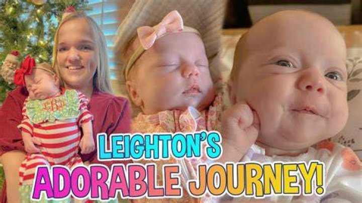 The Adorable Little Johnston Baby Dwarf: A Heartwarming Journey