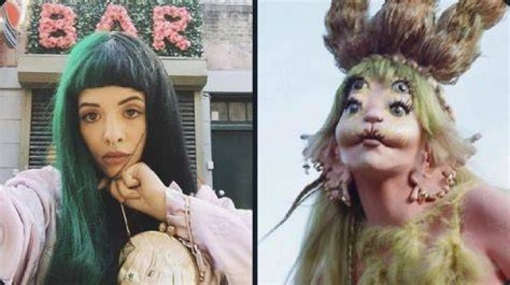 The Aftermath: Melanie Martinez After Surgery
