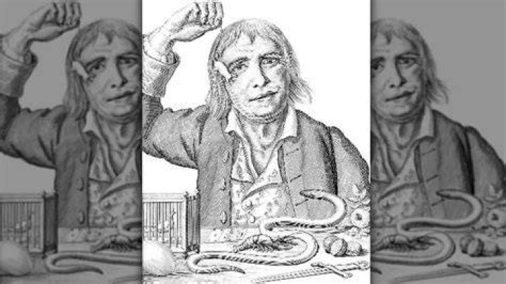 The Horrifying Autopsy Of Tarrare, The Man With An Unsatiable Appetite