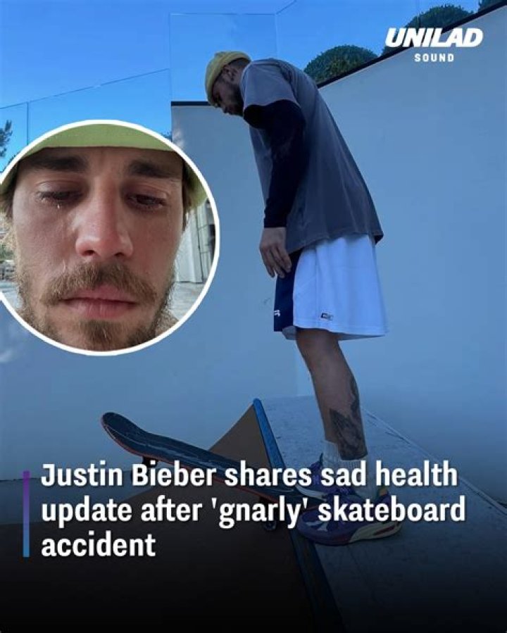 The Latest On Justin Bieber's Shocking Accident