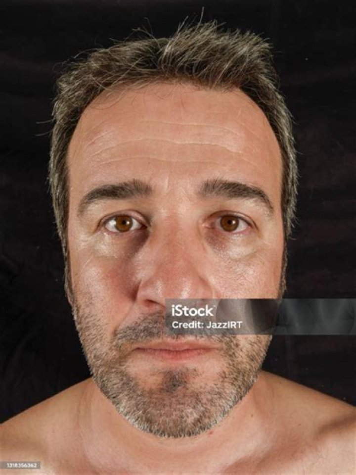 The Real Reasons Behind Physical Unattractiveness: Unveiling The Factors That Make A Person Ugly
