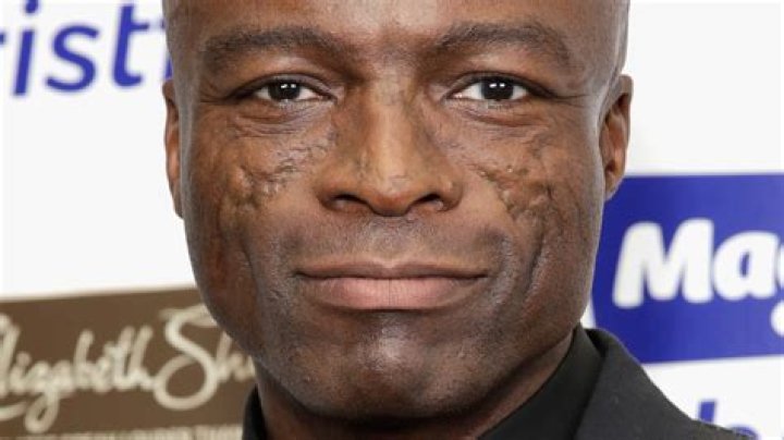 The Shocking Reason Why Seals Have Scars: Uncovering The Markings Of The Deep