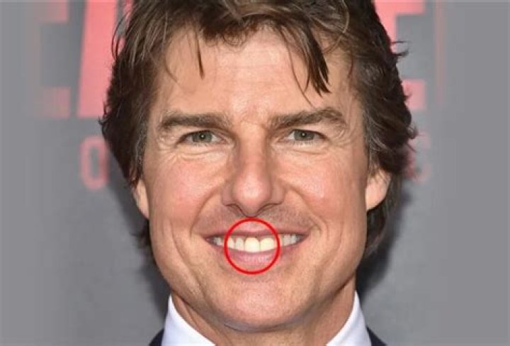 The Shocking Truth: Tom Cruise's Dental Disasters